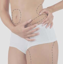 Liposuction